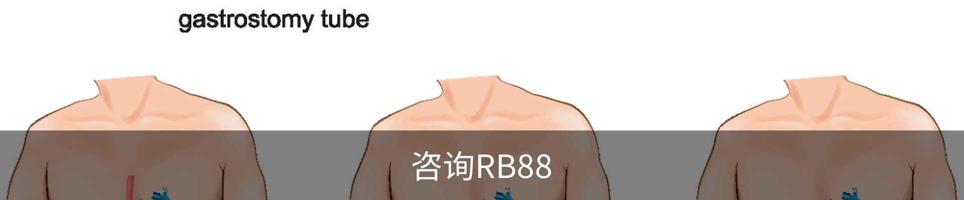 咨询RB88